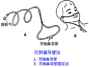 ◆肺病患者如何家庭氧療？